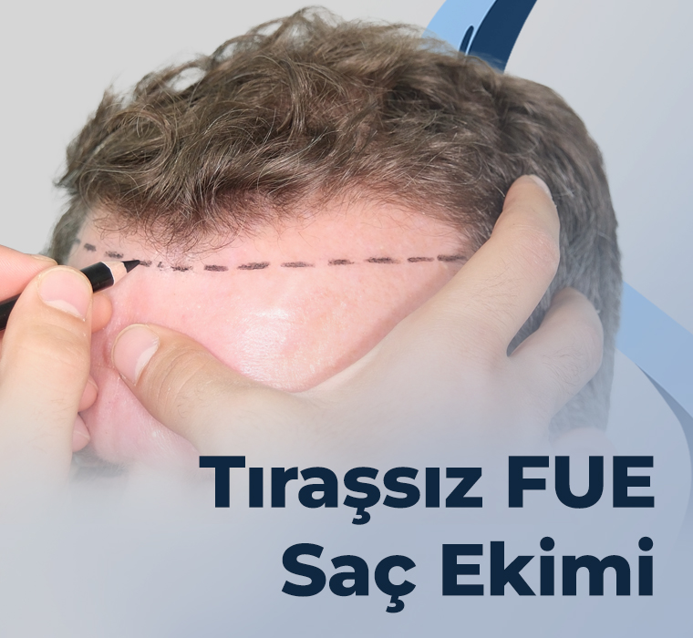 Tıraşsız FUE Saç Ekimi